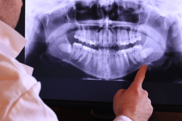 Best Emergency Cosmetic Dentistry (e.g., broken veneers) in Santaquin, UT